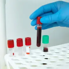 Ręka w niebieskiej rękawiczce trzyma probówkę z krwią nad stojakiem z próbówkami.